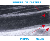 Bilan de santé, l'EIM