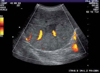 Bilan de santé, échographie abdominale